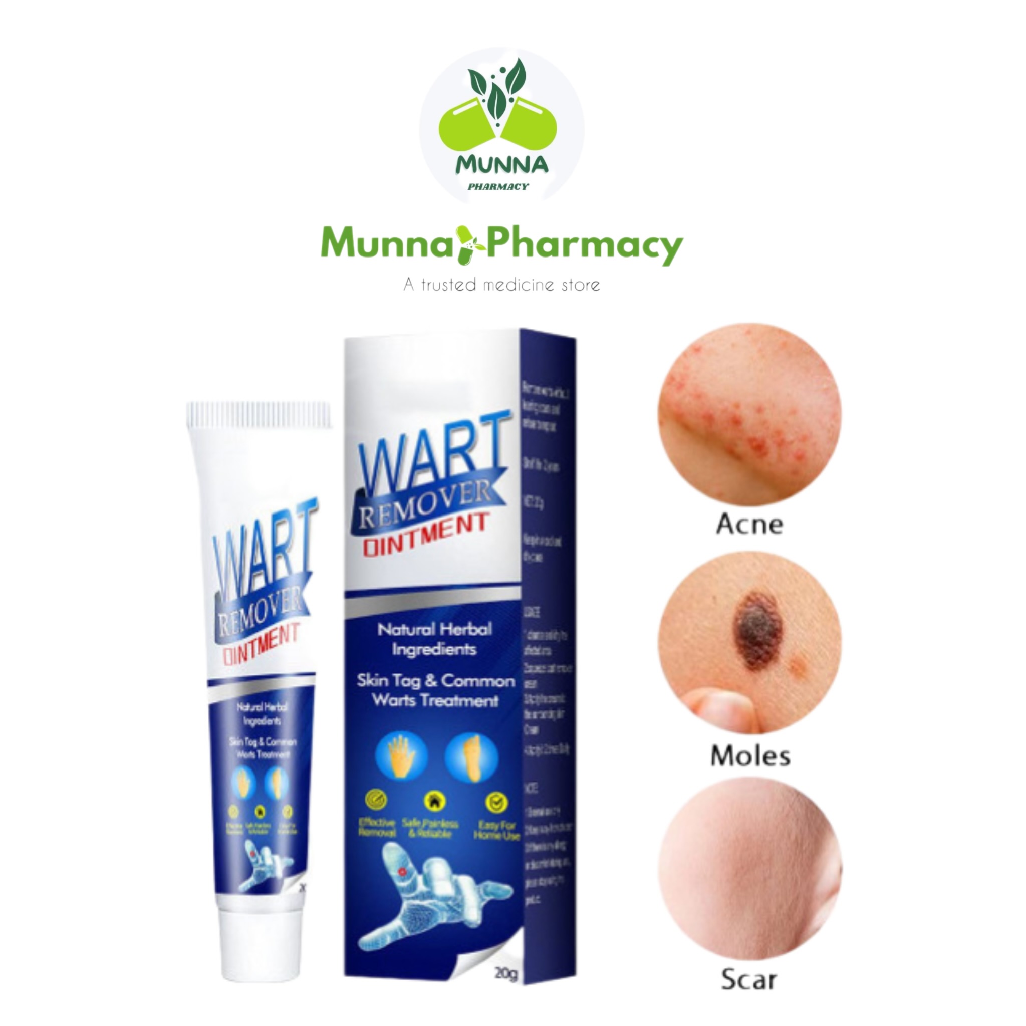 Wart Remover Ointment